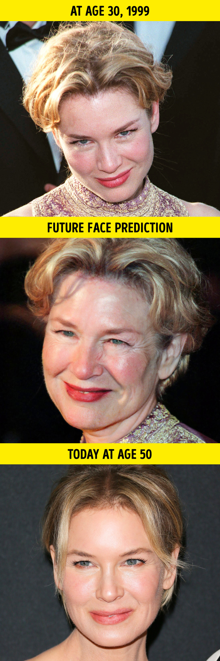 A Plastic Surgeon Reveals How 10 Celebrities Would Look If They Aged Like Average People