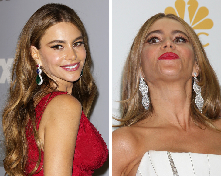 14 Celebrities Who Show That Nobody Is Safe From a Bad Photo