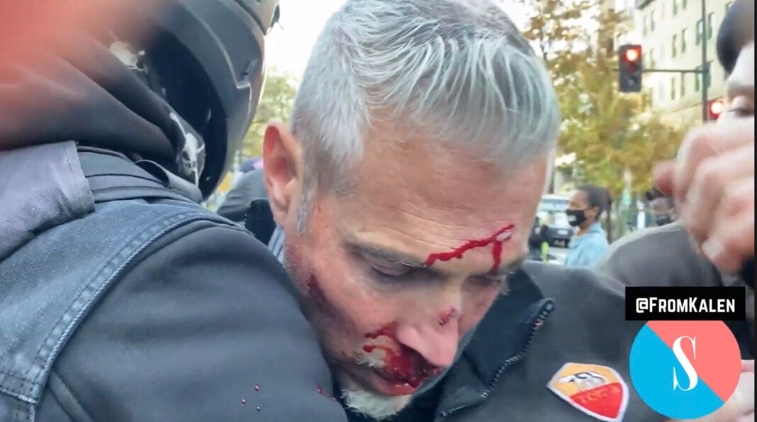 Χάος στην Ουάσιγκτον – έδειραν γυναίκες και ηλικιωμένους οπαδούς του Τραμπ  | newsbreak