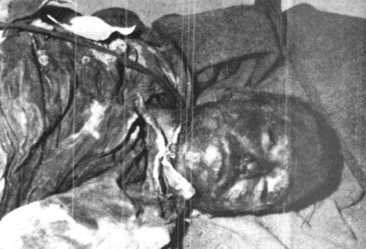 8 Αυγούστου 1964: Μάχη της Τηλλυρίας στην Κύπρο - Τουρκική πρόβα για τον Αττιλα 33 %CE%A0%CE%91%CE%9D%CE%91%CE%93%CE%99%CE%A9%CE%A4%CE%97%CE%A3 %CE%A7%CE%91%CE%A1%CE%91%CE%9B%CE%91%CE%9C%CE%A0%CE%9F%CE%A5%CE%A3