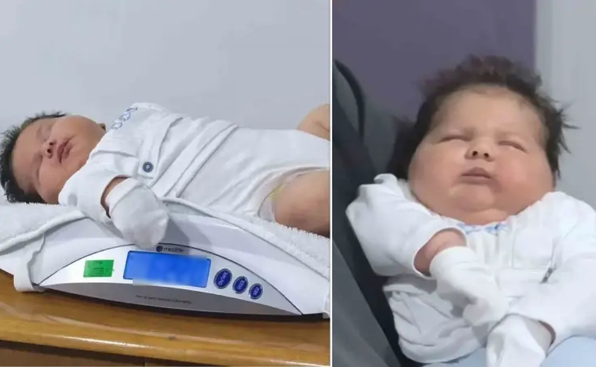 Βρέφος που ζύγιζε πάνω από 6 κιλά γεννήθηκε στην Τουρκία!